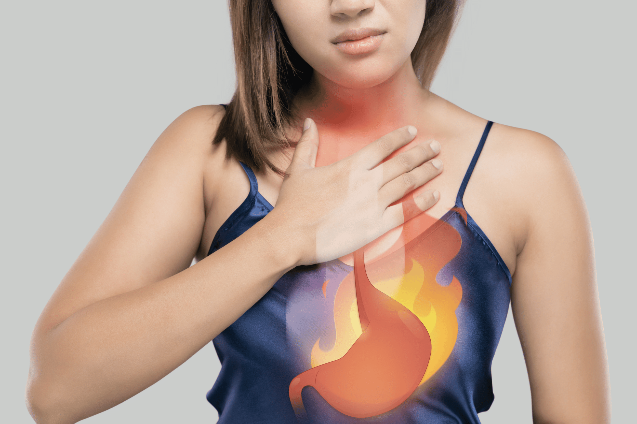 Acid Reflux Treatment New York