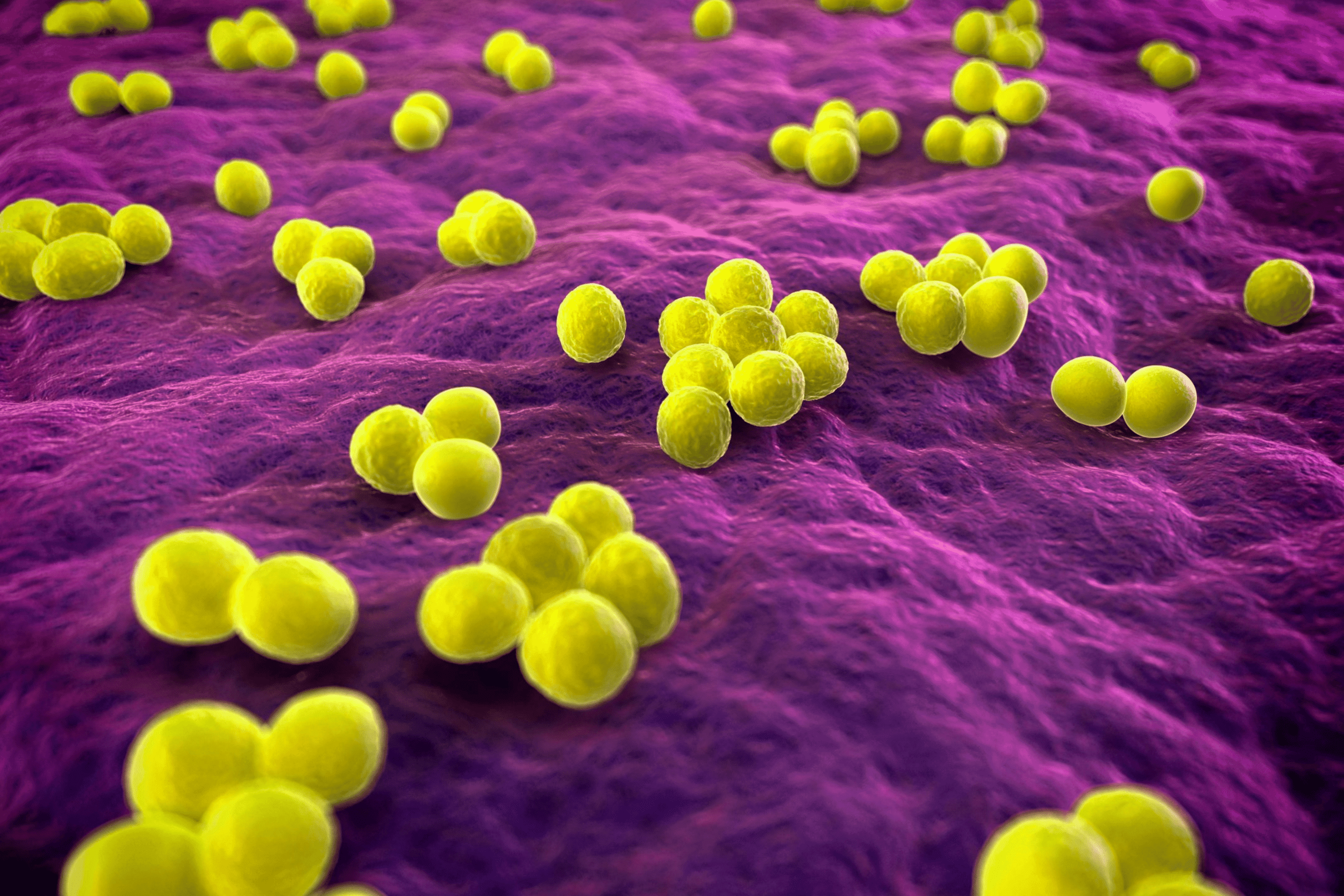Methicillin resistant Staphylococcus Aureus MRSA